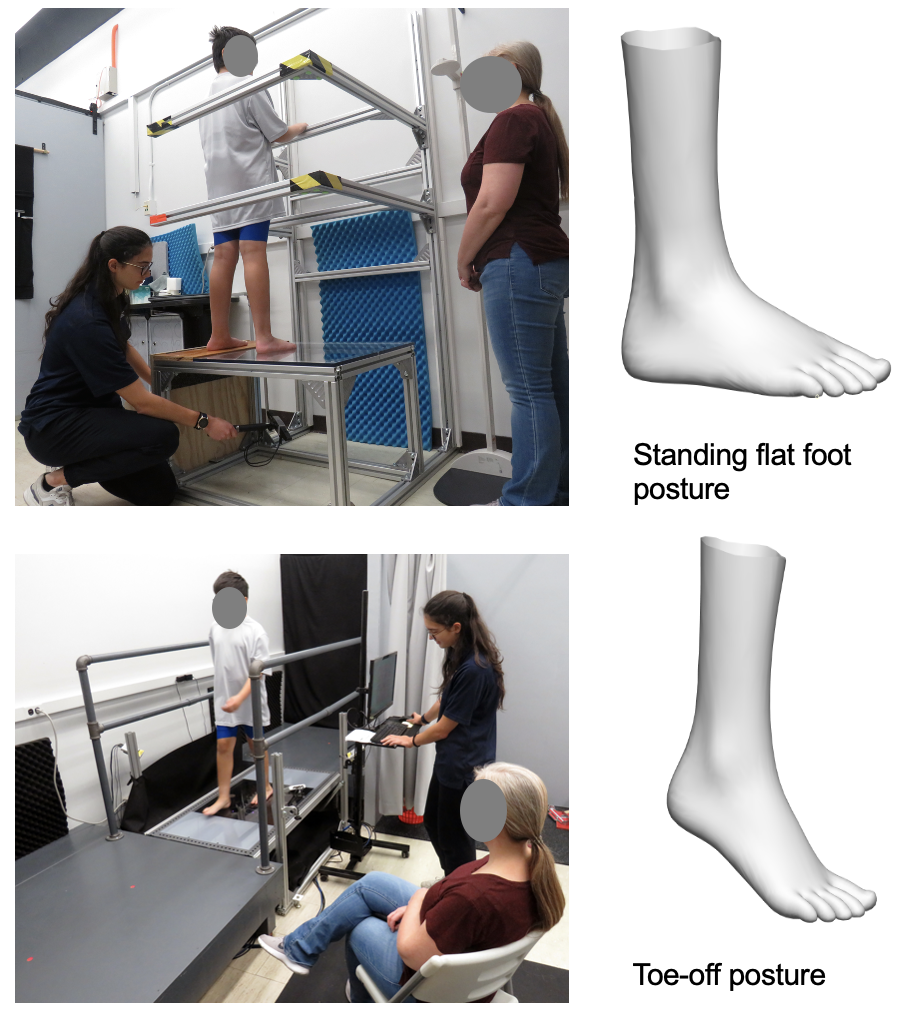 Foot Shape